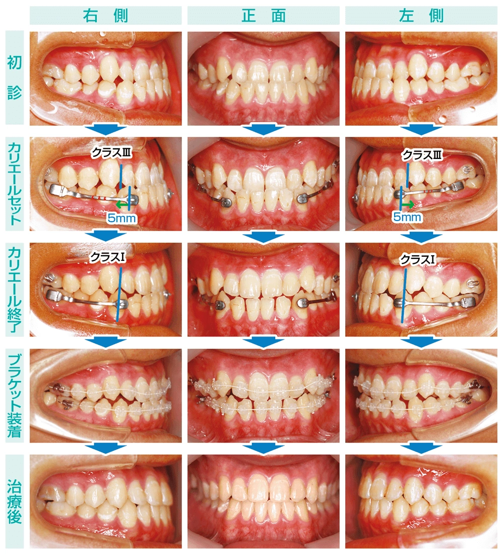 20240315-fukatsushika (2).png