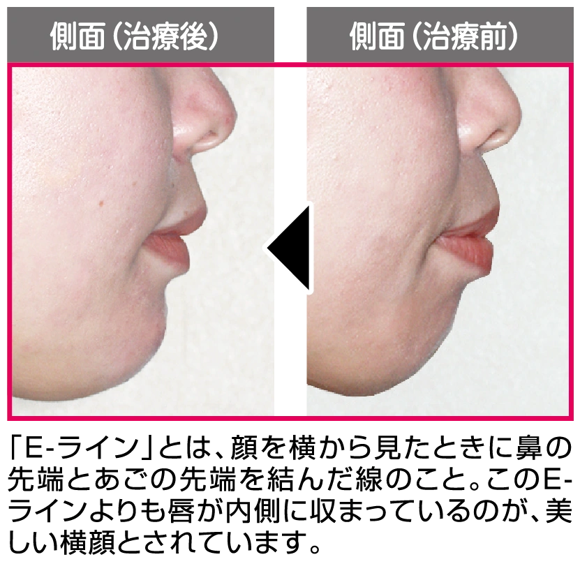 ふかつ歯科-02 (1).png