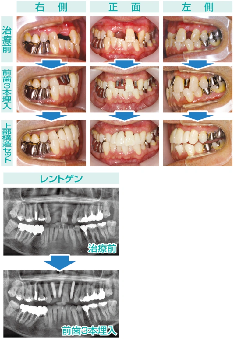 スクリーンショット-2025-03-23-175047-768x1114 (1).png