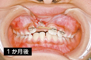 1か月後.jpg