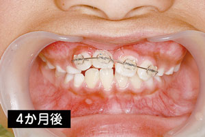4か月後.jpg