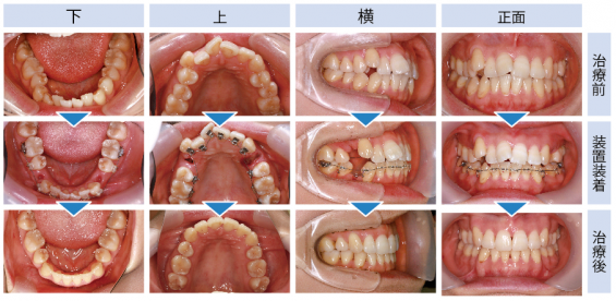 cms1430456704 222.png