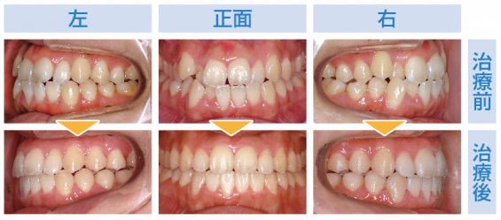 cms1433380684 333.png