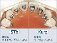 STbとKurzの比較画像